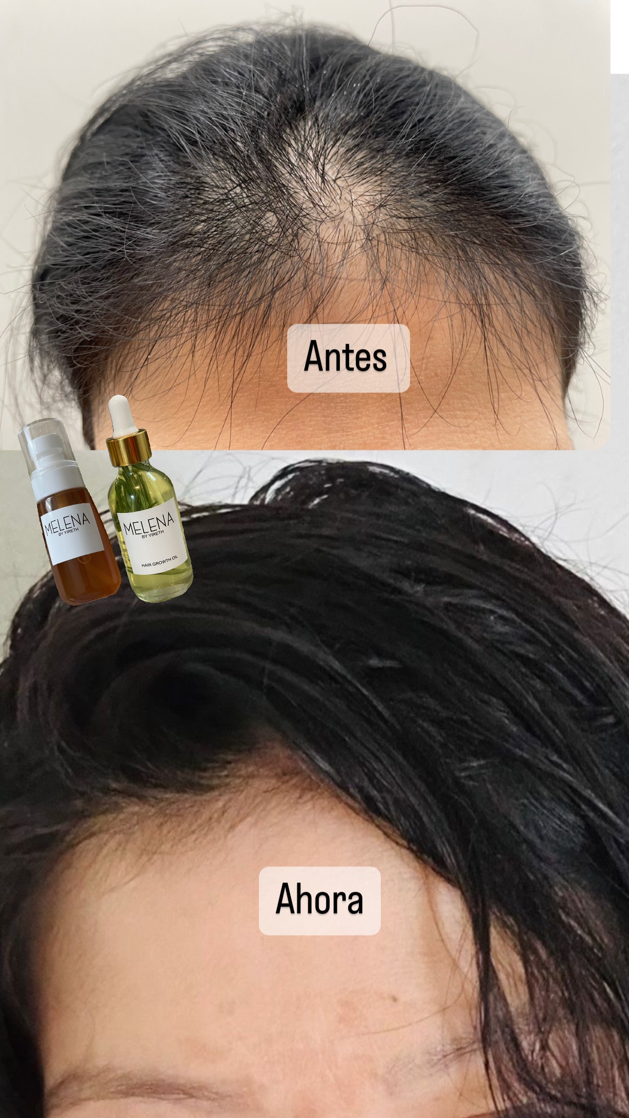 🌿 Melena Magic Kit – Heal Hair Damage & Regain Fullness🌱 FREE SHIPPING💕