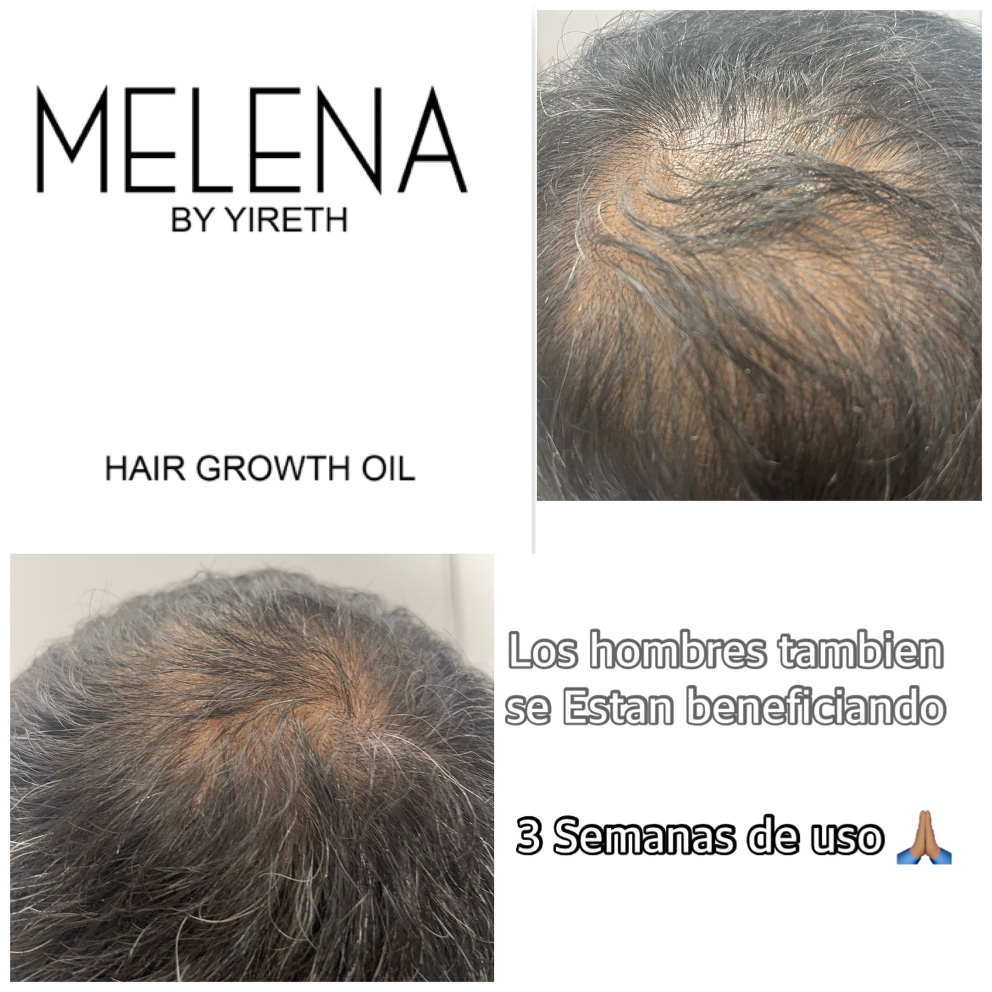 SOLD OUT Easy Squeeze Ayurvedic Hair Growth Oil