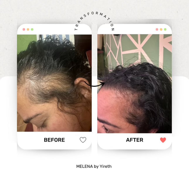 El aceite mágico🪄Magic Hair Growth Oil✨