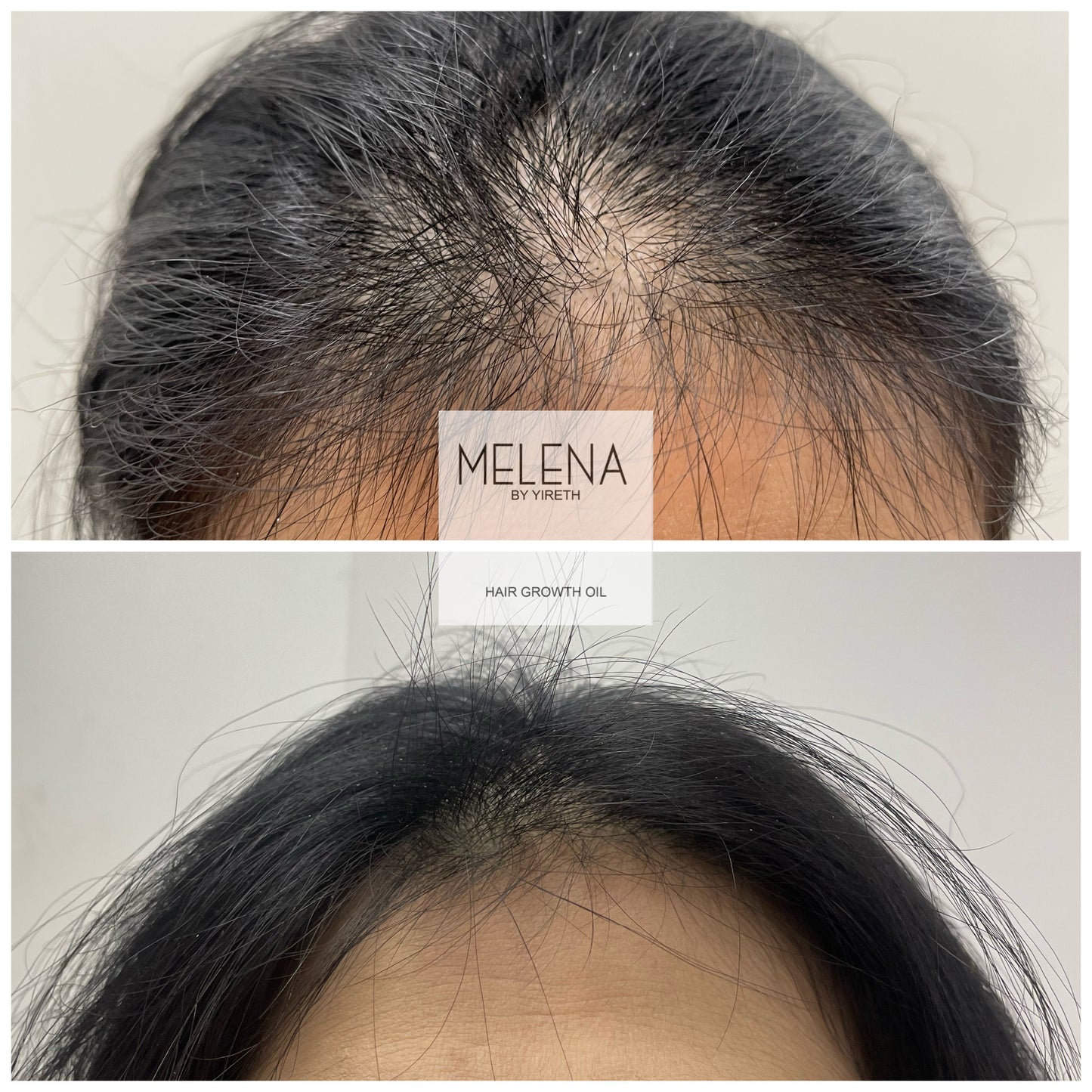🌿Intensive hair tonic D’Luz 🌿 (Hair Remedy)